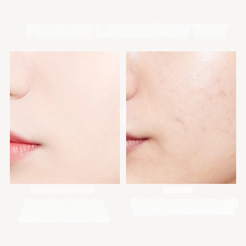 Gold Anti-Aging Toner 24K Gold Infused Skin Treatment - Detailed view