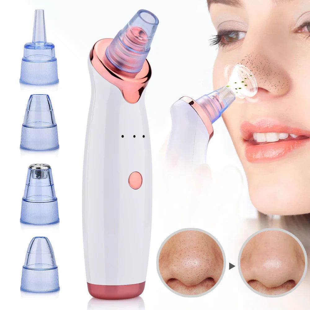 Blackhead Remover Vacuum 5 Suction Heads USB Charging - Detailed view