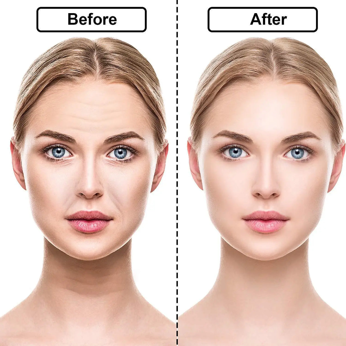 Anti-Wrinkle Silicone Patches  Professional Facial Treatment Set - Product detail 5