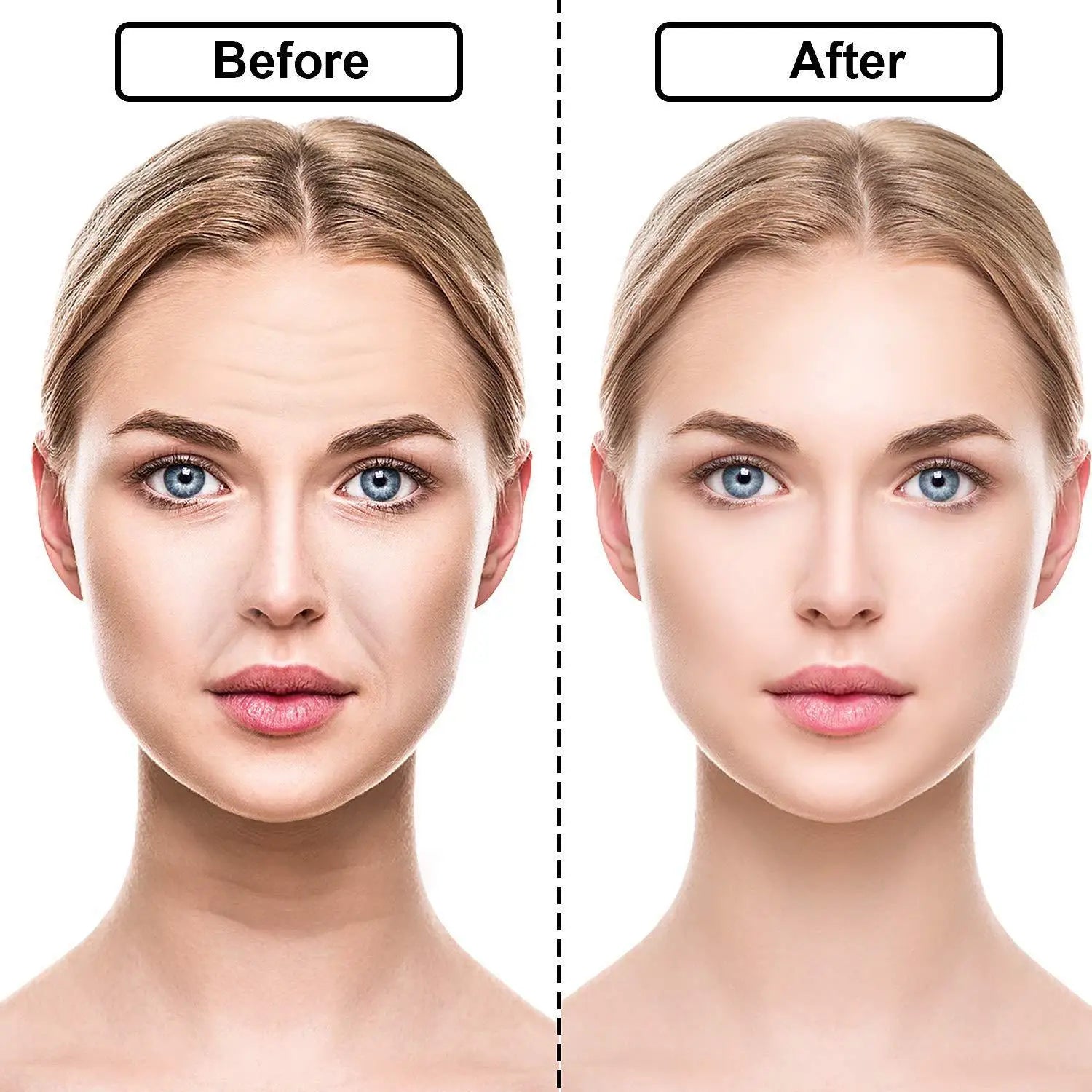 Anti-Wrinkle Silicone Patches  Professional Facial Treatment Set - Product detail 5
