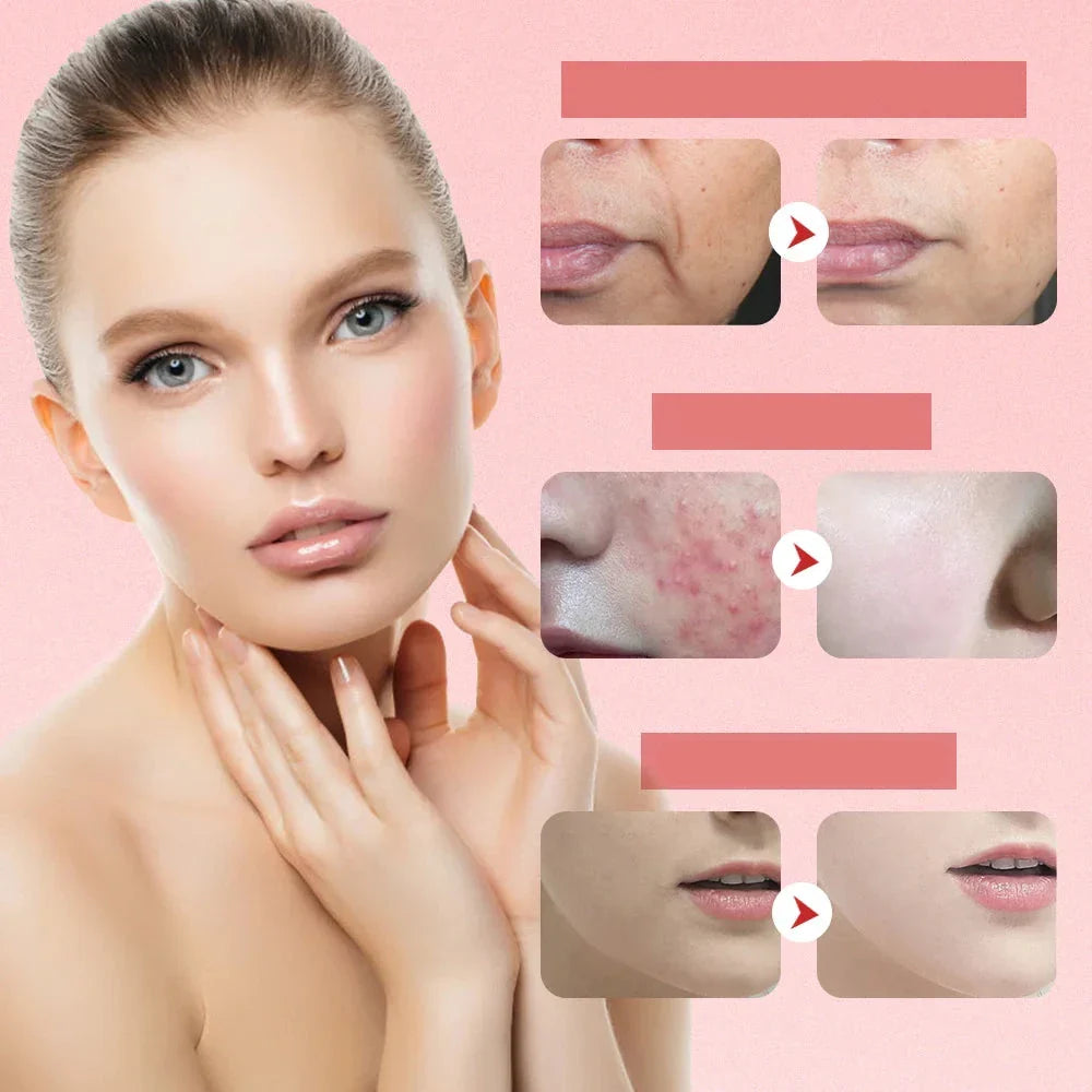 Advanced Facial Massager  LED Light Therapy with EMS Technology - Product example