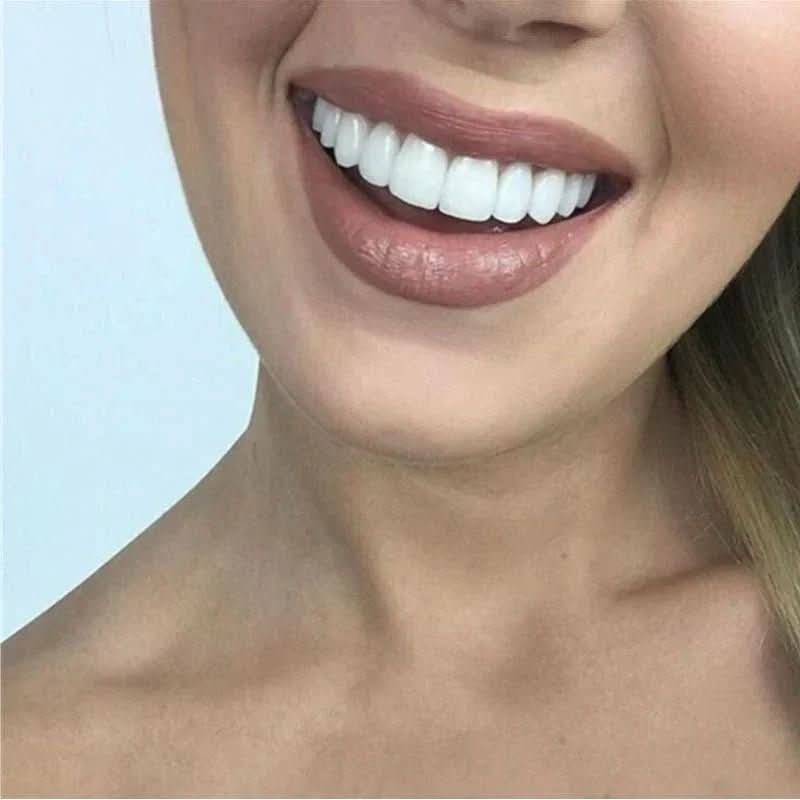 Customizable Dental Veneers Snap-On Teeth Whitening Solution - Product example