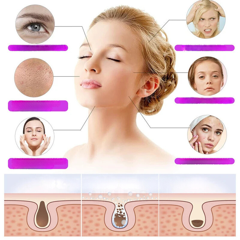 High Frequency Facial Wand  Professional Skincare Device With 4 Electrodes - Detailed view