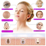 High Frequency Facial Wand  Professional Skincare Device With 4 Electrodes - Detailed view