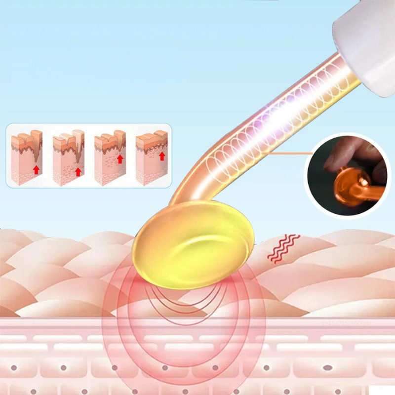 High Frequency Facial Device  Professional Skin Tightening Wand - Product detail 4