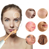 High Frequency Facial Device  Professional Skin Tightening Wand - Detailed view
