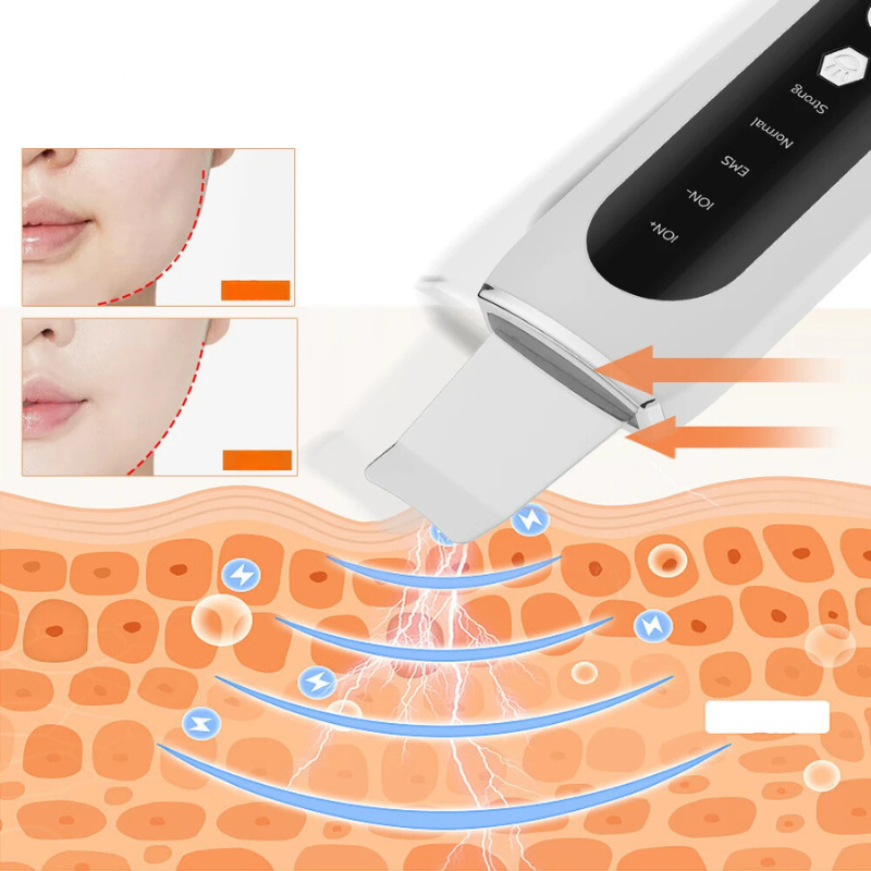 Ultrasonic Pore Cleanser  Professional LED Light Therapy - Product detail 4