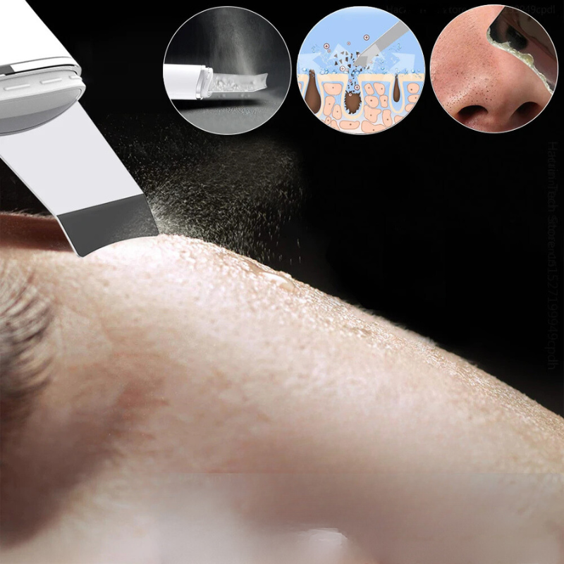 Ultrasonic Facial Exfoliator  Digital LED Display with EMS Technology - Product example