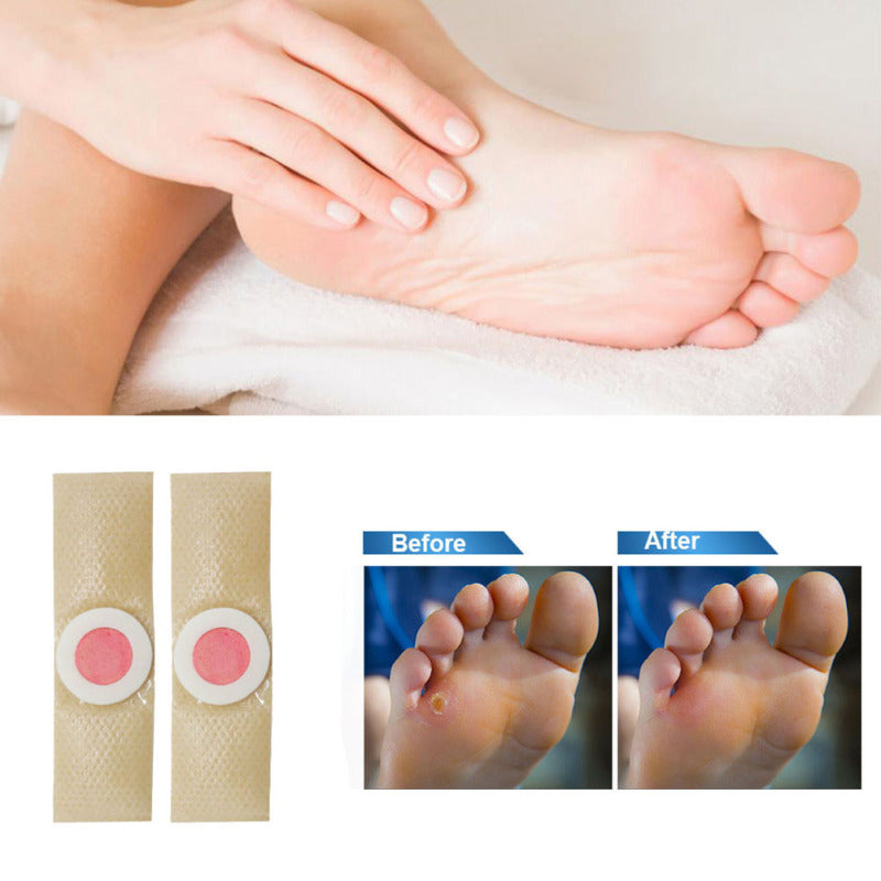 Foot Care Corn Pads  Medical-Grade Pain Relief Plasters - Product detail 4