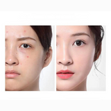 Hydrating Essence Toner  Soothing Acne Care Formula - Product example
