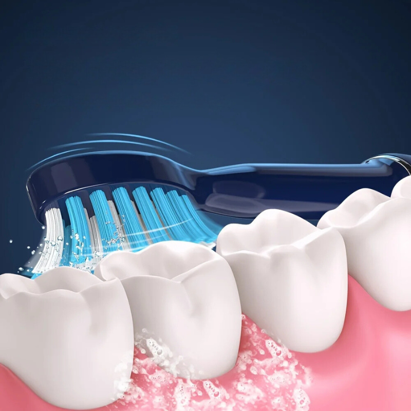 Sonic Electric Toothbrush  Triple Speed DuPont Bristles - Product detail 5