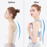 Ergonomic Back Posture Corrector  Adjustable Support System - Product detail 4