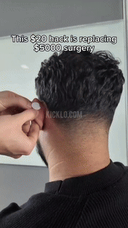Waterproof Ear Corrector  Medical-Grade Silicone Patches - Detailed view
