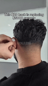 Waterproof Ear Corrector  Medical-Grade Silicone Patches - Detailed view