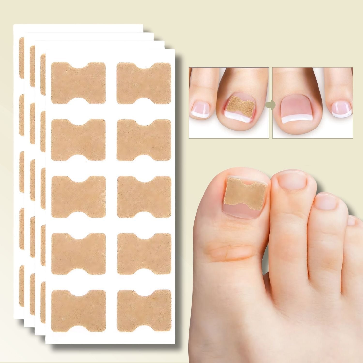 Nail Treatment Patches  Medical-Grade Adhesive Correction System - Product showcase