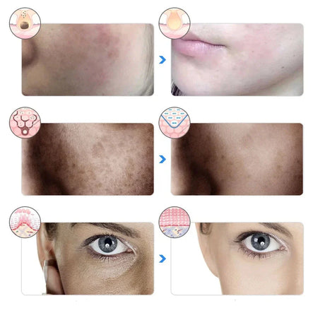 LED Light Therapy Mask  7-Color Professional Facial Treatment - Product detail 5