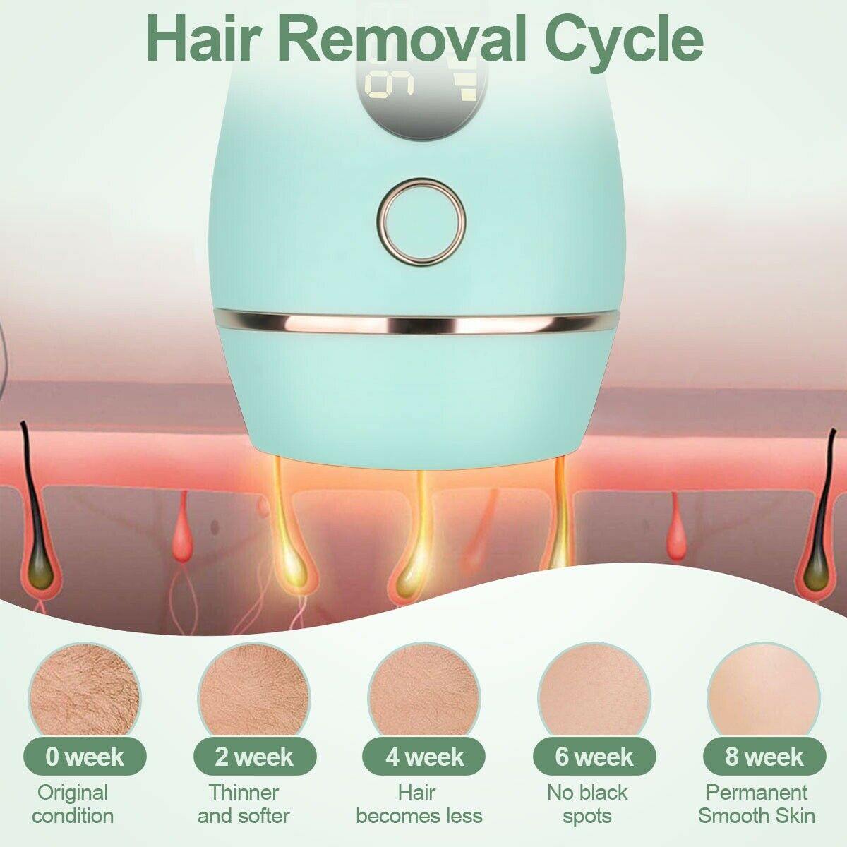 Professional IPL Hair Removal Device  5-Level Smart Technology - Detailed view