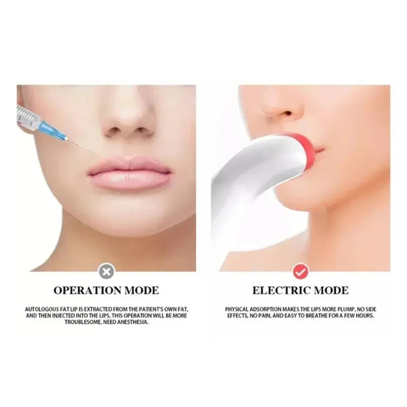 Natural Lip Enhancement Device  Electric Silicone Plumping System - Product detail 7
