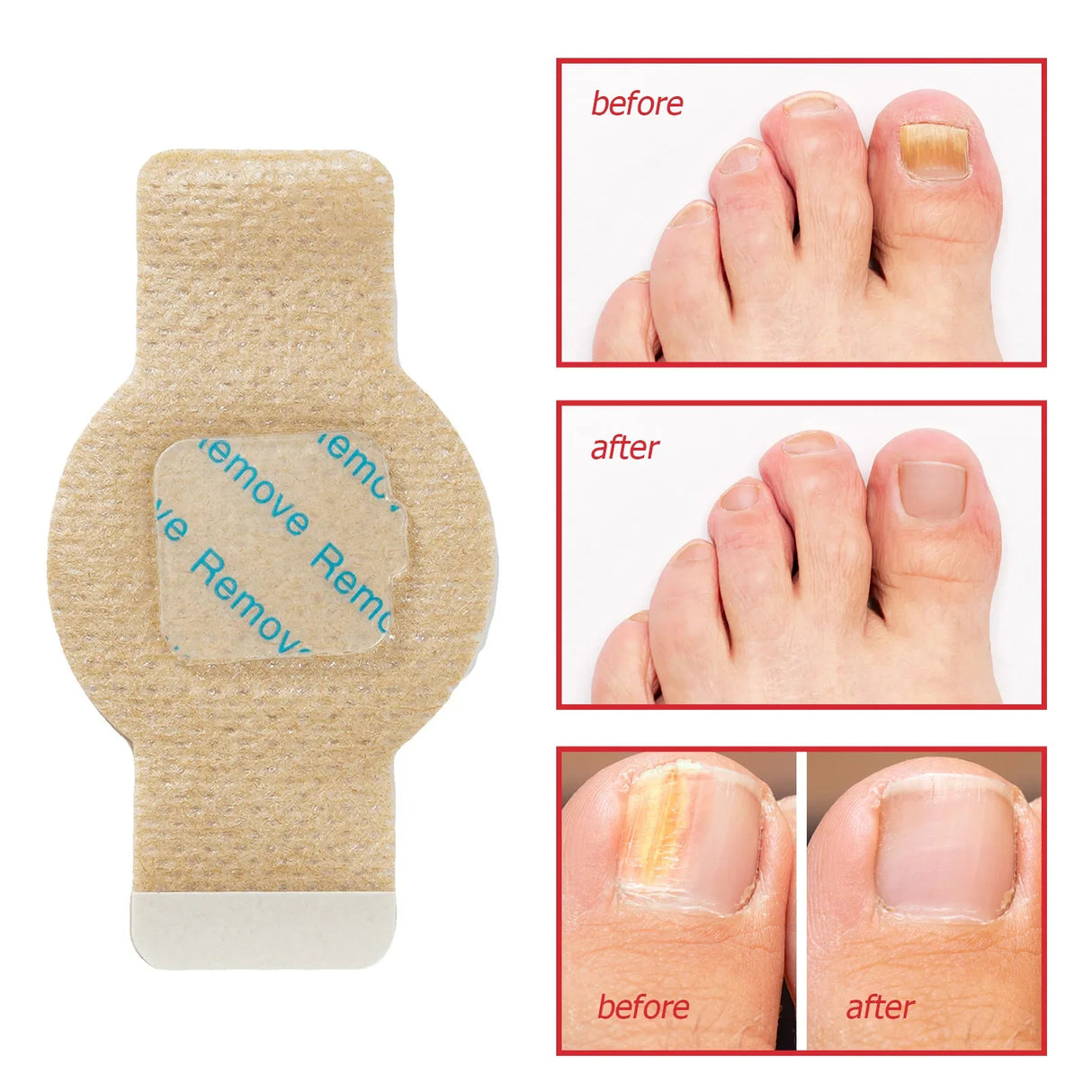 Antifungal Nail Treatment  Overnight Hydrogel Repair Patches - Product detail 5