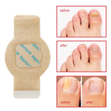 Antifungal Nail Treatment  Overnight Hydrogel Repair Patches - Product detail 5