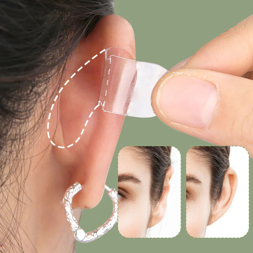 Professional Ear Shaping Stickers  Invisible Support Patches - Detailed view