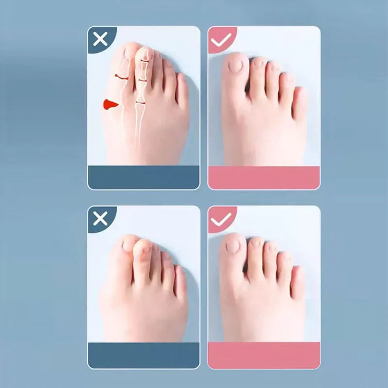 Medical Toe Separator  Silicone Bunion Corrector For Pain Relief - Product detail 5