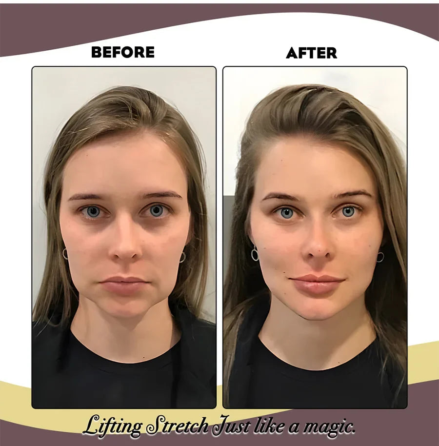 Face Lifting Band  Invisible Elastic Support Band - Detailed view