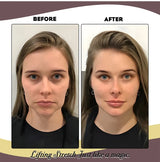 Face Lifting Band  Invisible Elastic Support Band - Detailed view