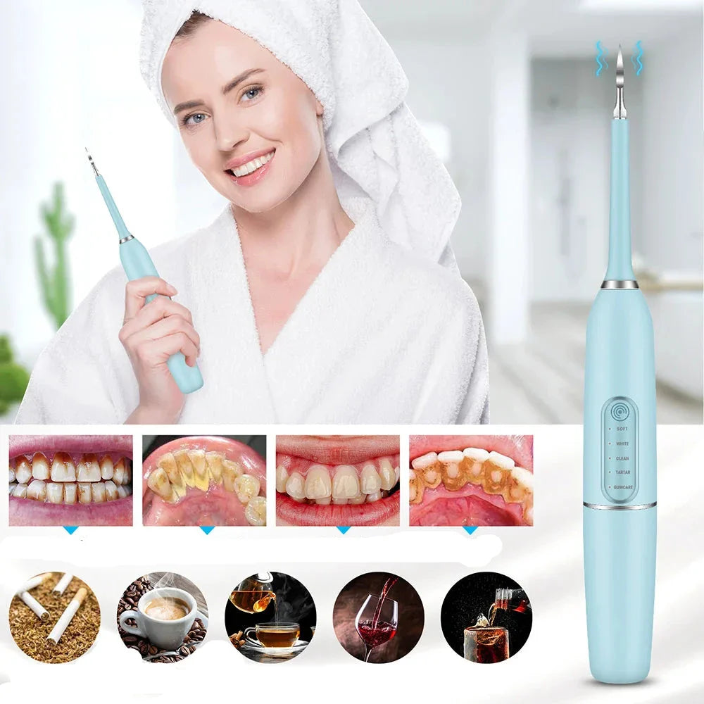 Sonic Teeth Cleaning Device  Professional Tartar  Plaque Remover - Product showcase