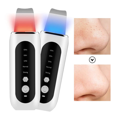 Ultrasonic Pore Cleanser  Professional LED Light Therapy - Product showcase
