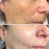 Natural Turmeric Toner  Vitamin C  Ginger Extract Blend - Product example