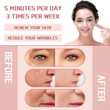 Anti-Aging Eye Massager  LED Red Light Therapy Device - Product detail 5