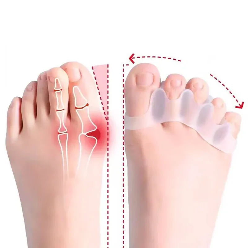 Medical Toe Separator  Silicone Bunion Corrector For Pain Relief - Product showcase