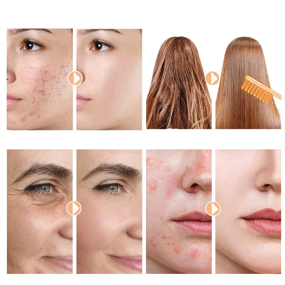 High Frequency Facial Device  Professional Skin Tightening Wand - Product detail 6