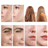High Frequency Facial Device  Professional Skin Tightening Wand - Product detail 6