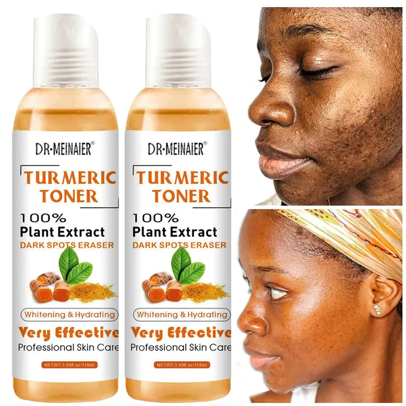 Natural Turmeric Toner  Vitamin C  Ginger Extract Blend - Detailed view