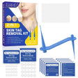 Professional Skin Tag Removal Kit  2-in-1 Silicone Ligation System - Product showcase