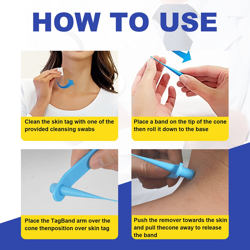 Professional Skin Tag Removal Kit  2-in-1 Silicone Ligation System - Product detail 4