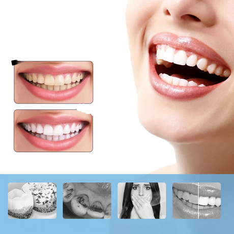 Electric Teeth Whitening Device  6-Speed Professional Scaler - Product showcase