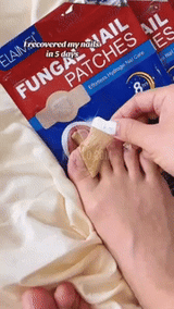 Antifungal Nail Treatment  Overnight Hydrogel Repair Patches - Detailed view