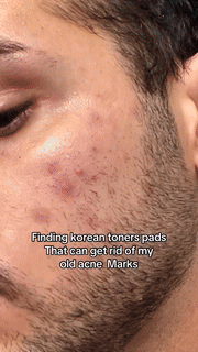 Pore Refining Toner Pads  AHA BHA Exfoliating Treatment - Detailed view