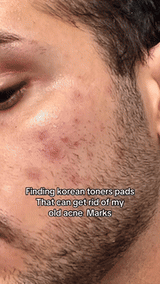 Pore Refining Toner Pads  AHA BHA Exfoliating Treatment - Detailed view