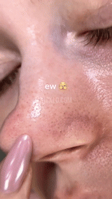 Deep Cleansing Nose Patches  Hydrocolloid Pore Treatment - Detailed view