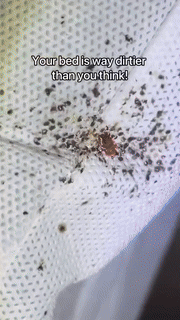 UV Dust Mite Vacuum Cleaner  13KPa Ultrasonic Deep Cleaning - Detailed view